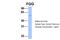 Fibrinogen Gamma Chain antibody, ARP44299_P050, Aviva Systems Biology, Western Blot image 