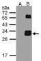 Kallikrein Related Peptidase 7 antibody, orb73745, Biorbyt, Western Blot image 