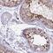 THAP Domain Containing 5 antibody, NBP1-92497, Novus Biologicals, Immunohistochemistry paraffin image 