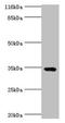 Transmembrane And Coiled-Coil Domains 5A antibody, LS-C378645, Lifespan Biosciences, Western Blot image 