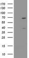 TRNA Methyltransferase 2 Homolog A antibody, TA505525AM, Origene, Western Blot image 