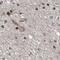 ALC1 antibody, PA5-55689, Invitrogen Antibodies, Immunohistochemistry paraffin image 