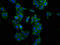 Leucine Rich Pentatricopeptide Repeat Containing antibody, LS-C673114, Lifespan Biosciences, Immunofluorescence image 