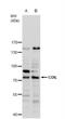 Coilin antibody, NBP2-15939, Novus Biologicals, Western Blot image 