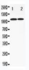 Toll Like Receptor 3 antibody, PA1740, Boster Biological Technology, Western Blot image 