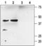 Potassium Calcium-Activated Channel Subfamily M Regulatory Beta Subunit 2 antibody, PA5-77596, Invitrogen Antibodies, Western Blot image 