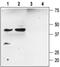 Potassium Calcium-Activated Channel Subfamily M Regulatory Beta Subunit 2 antibody, PA5-77596, Invitrogen Antibodies, Western Blot image 