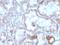 TNF Receptor Superfamily Member 9 antibody, GTX02726, GeneTex, Immunohistochemistry paraffin image 