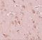 GRB2 Associated Regulator Of MAPK1 Subtype 2 antibody, A17028, Boster Biological Technology, Immunohistochemistry frozen image 