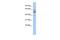 Transmembrane And Coiled-Coil Domain Family 1 antibody, GTX46650, GeneTex, Western Blot image 