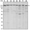 SET Domain Bifurcated Histone Lysine Methyltransferase 1 antibody, ab107225, Abcam, Western Blot image 