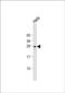 Ras-related protein Rab-34 antibody, PA5-72451, Invitrogen Antibodies, Western Blot image 