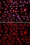 Core-Binding Factor Subunit Beta antibody, GTX33066, GeneTex, Immunofluorescence image 