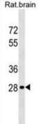 Homeobox D9 antibody, abx029622, Abbexa, Western Blot image 