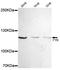 FYN Binding Protein 1 antibody, STJ99143, St John