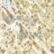 C-Terminal Binding Protein 1 antibody, A1707, ABclonal Technology, Immunohistochemistry paraffin image 
