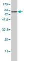 Phosphorylase Kinase Catalytic Subunit Gamma 2 antibody, H00005261-M05, Novus Biologicals, Western Blot image 