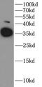 Arginase 1 antibody, FNab04800, FineTest, Western Blot image 