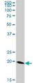 Ferritin Mitochondrial antibody, H00002495-B01P, Novus Biologicals, Western Blot image 