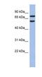 Guanine nucleotide-binding protein-like 3-like protein antibody, NBP1-55240, Novus Biologicals, Western Blot image 