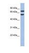 G Protein Nucleolar 3 Like antibody, NBP1-55240, Novus Biologicals, Western Blot image 