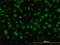 RAD54 Homolog B antibody, H00025788-M01, Novus Biologicals, Immunocytochemistry image 