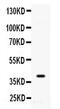 Adenosine Kinase antibody, PA5-78731, Invitrogen Antibodies, Western Blot image 