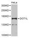 DOT1 Like Histone Lysine Methyltransferase antibody, orb373653, Biorbyt, Western Blot image 