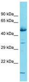 Glucocorticoid-induced transcript 1 protein antibody, TA340288, Origene, Western Blot image 