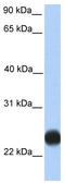 Transmembrane Protein 123 antibody, TA342076, Origene, Western Blot image 