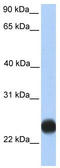 Porimin antibody, TA342076, Origene, Western Blot image 