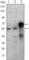ETS Proto-Oncogene 1, Transcription Factor antibody, abx010752, Abbexa, Western Blot image 
