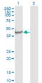 Neuronal Pentraxin 1 antibody, LS-C197799, Lifespan Biosciences, Western Blot image 