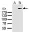 Roundabout Guidance Receptor 1 antibody, PA5-34932, Invitrogen Antibodies, Western Blot image 