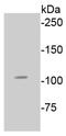 EPH Receptor A4 antibody, NBP2-67338, Novus Biologicals, Western Blot image 