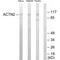 Actinin Alpha 2 antibody, MBS9406192, MyBioSource, Western Blot image 