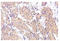 Serine/threonine-protein kinase Chk2 antibody, AP20932PU-N, Origene, Immunohistochemistry paraffin image 