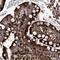 Defective In Cullin Neddylation 1 Domain Containing 4 antibody, NBP1-81527, Novus Biologicals, Immunohistochemistry frozen image 