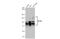 SP100 Nuclear Antigen antibody, GTX131569, GeneTex, Western Blot image 