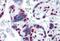 Heterogeneous Nuclear Ribonucleoprotein M antibody, MBS245794, MyBioSource, Immunohistochemistry paraffin image 