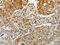 O-GlcNAcase antibody, CSB-PA910720, Cusabio, Immunohistochemistry paraffin image 
