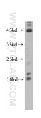 Anaphase Promoting Complex Subunit 15 antibody, 20409-1-AP, Proteintech Group, Western Blot image 