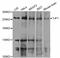Tight Junction Protein 1 antibody, abx126706, Abbexa, Western Blot image 
