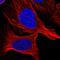 ATM Interactor antibody, HPA054967, Atlas Antibodies, Immunofluorescence image 