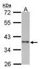 Cyclin I Family Member 2 antibody, PA5-21777, Invitrogen Antibodies, Western Blot image 