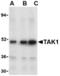 Mitogen-Activated Protein Kinase Kinase Kinase 7 antibody, TA306186, Origene, Western Blot image 