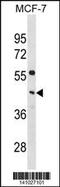 Phosphate Cytidylyltransferase 1, Choline, Alpha antibody, 60-679, ProSci, Western Blot image 