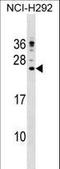 Cathelicidin Antimicrobial Peptide antibody, LS-C168291, Lifespan Biosciences, Western Blot image 