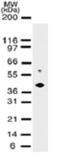 TRNA Aspartic Acid Methyltransferase 1 antibody, GTX13899, GeneTex, Western Blot image 