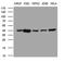 Ceramide Synthase 2 antibody, MA5-27228, Invitrogen Antibodies, Western Blot image 